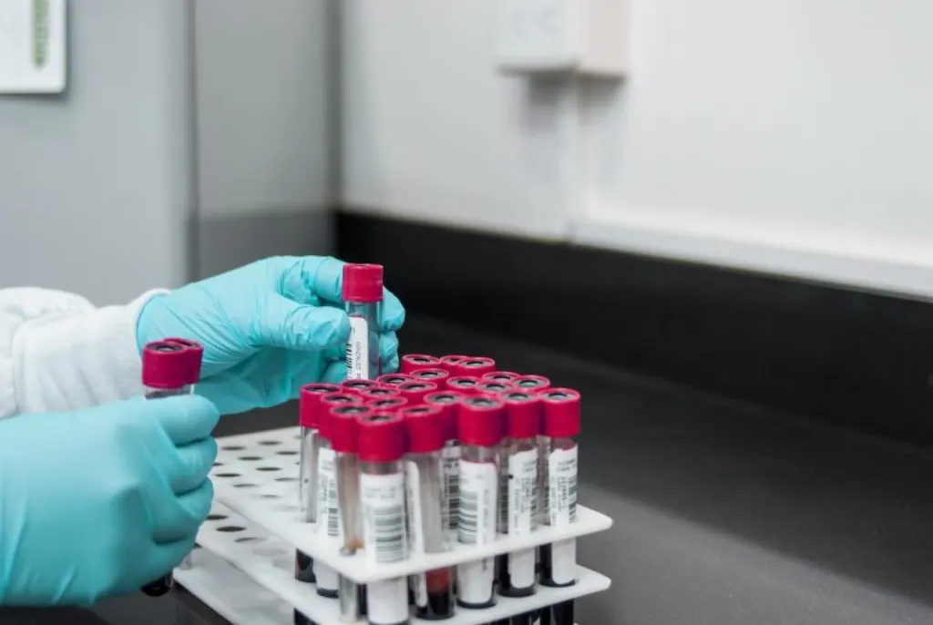 découvrez l'importance des tests sanguins pour surveiller votre santé. informez-vous sur les différents types d'analyses, leur rôle dans le diagnostic des maladies et comment elles peuvent vous aider à prendre des décisions éclairées sur votre bien-être.
